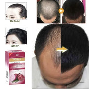 Nourishing Hair Growth Oil - 1 Pcs for Stimulating Scalp & Preventing Damage - Curerology